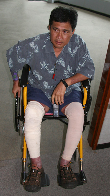 Aziz Ahmad in wheel chair